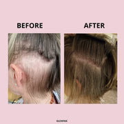 Glowa hair food