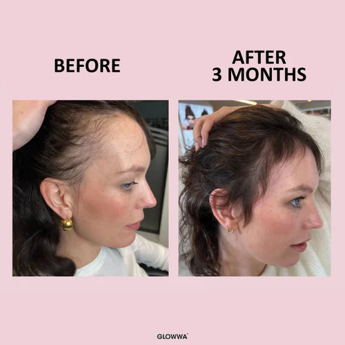 GLOWWA HAIR FOOD 3 month supply
