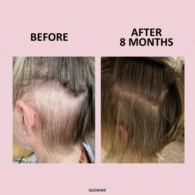 GLOWWA HAIR FOOD 1 month supply